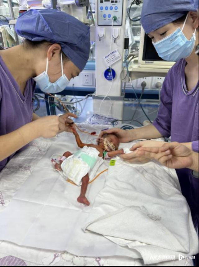深圳这名超早产儿2个月后顺利出院