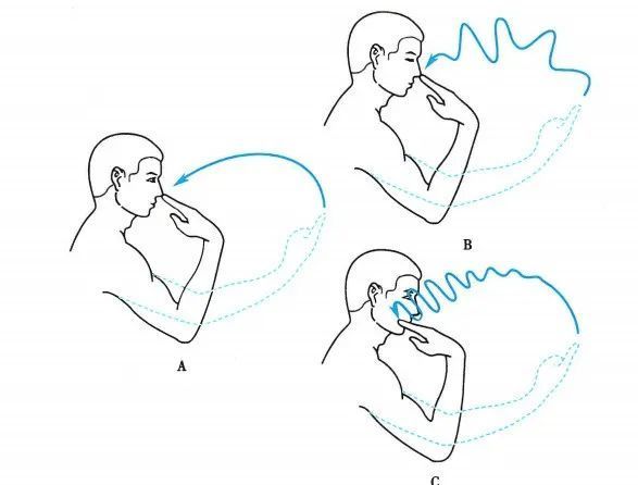 图10.指鼻试验 a.正常;b.感觉性共济失调;c.