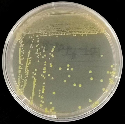 揭开未知菌种的神秘面纱