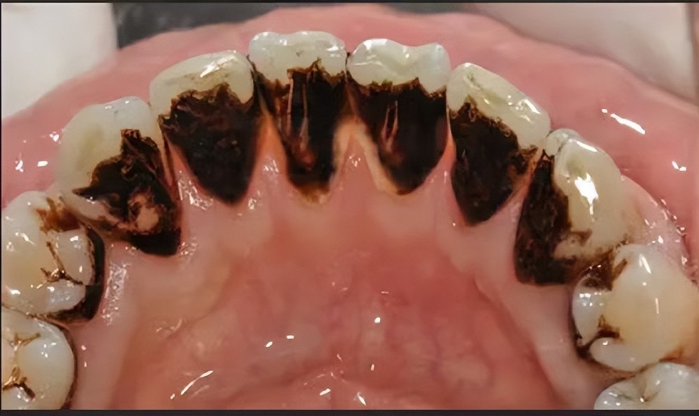 长期抽烟烟渍发臭发黑?过来人教你不戒烟在家轻松去口臭的方法!