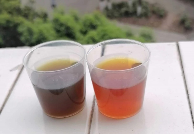 反复肝功能异常伴肠梗阻为哪般卟啉病临床诊疗思路