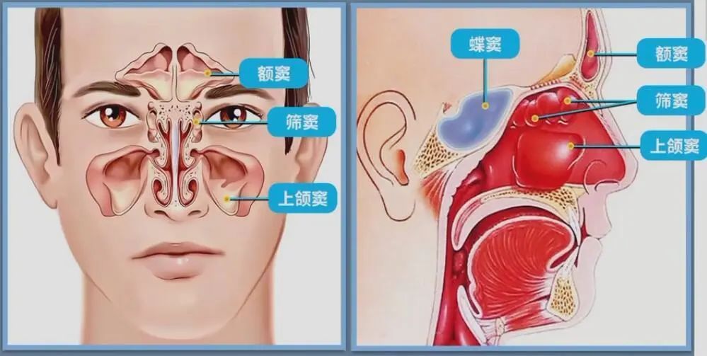 什么叫副鼻窦炎 腾讯网