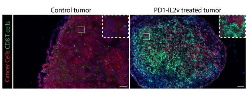 immunity联合抗pdl1的新型药物组合研究发现这种组合可