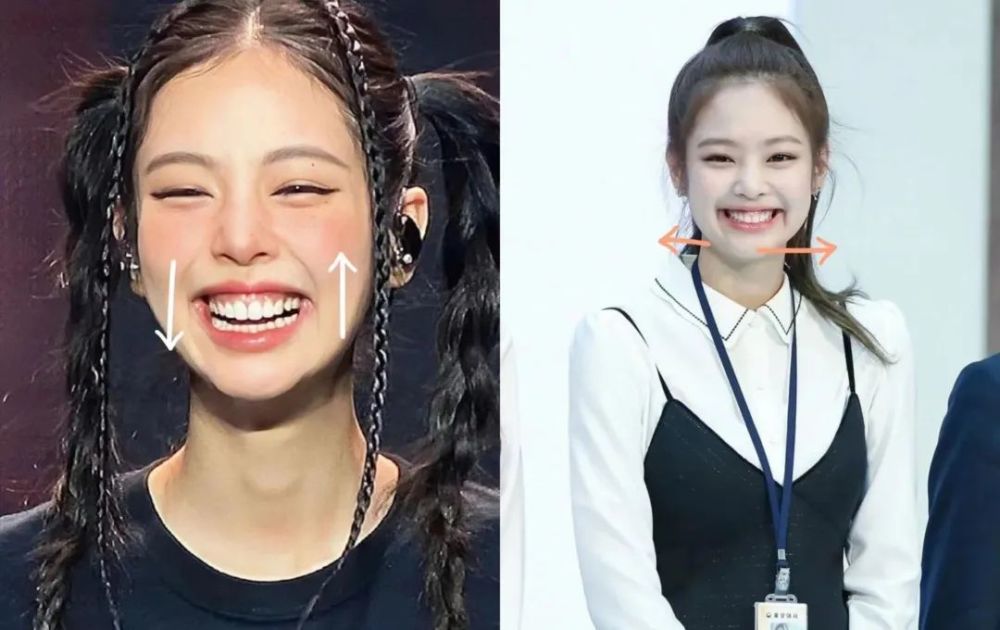 所以针对笑容容易局促,假笑感明显的姐妹,改用嘴角处的口轮匝肌发力