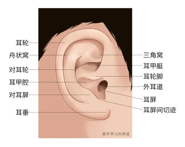 指開口在除了耳前以外的其他部位,如出現在圖2中的三角窩,耳甲艇,耳輪