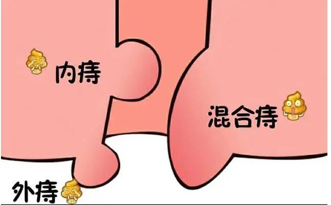 痔瘡給身體帶來哪些危害?_騰訊新聞