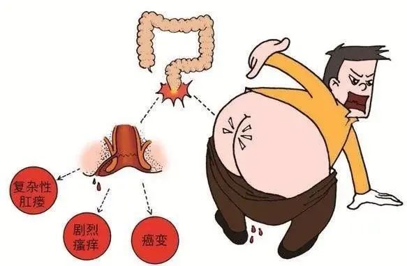 痔瘡肉球照片多年的老痔瘡患者說出了這樣的答案