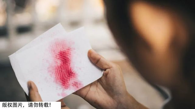 红痰:当痰内有血液,主要是有血红蛋白,痰的颜色就会趋向红色.