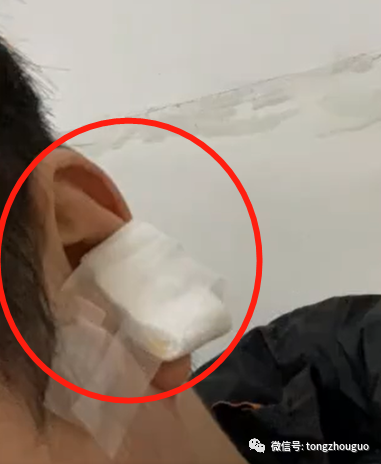 "后面我就拦住了他们,他们的店长跟我说,你耳朵受伤了而已,也不会