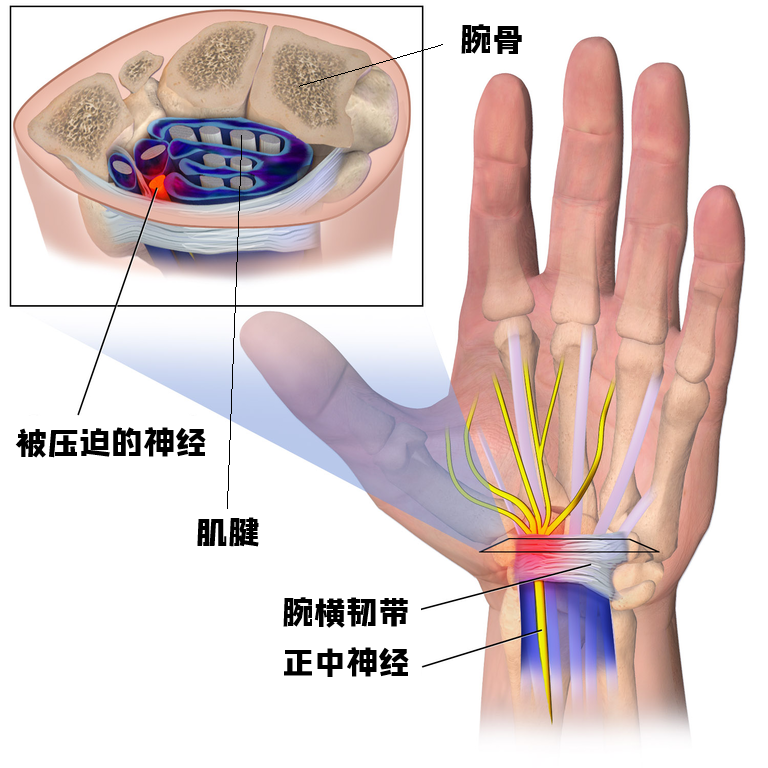 腕部静脉示意图图片