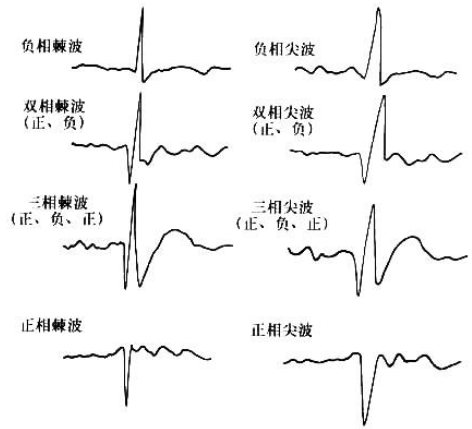 神经电生理检查:脑电图与脑磁图_成人教育_教育新闻 - 265学校教育网