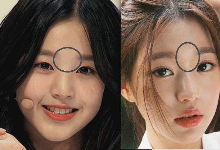 复习一下眉心三角区在哪,位于山根之上,双眉之