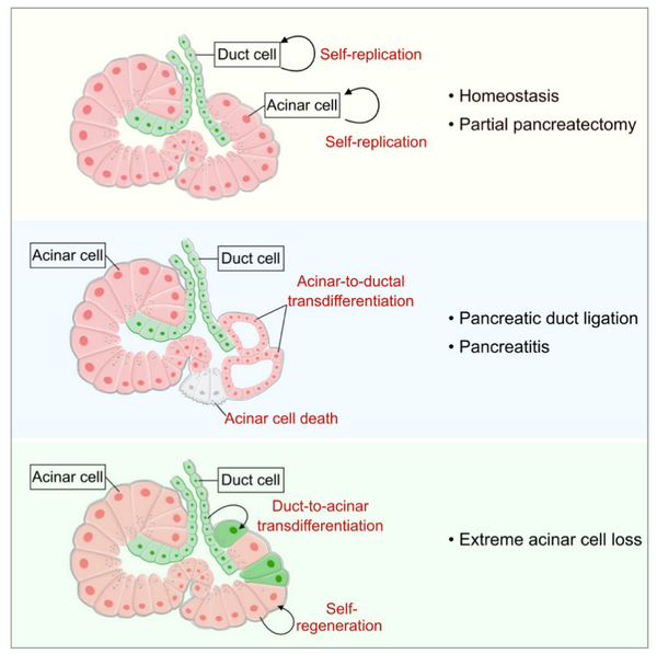 ductalcarcinoma图片