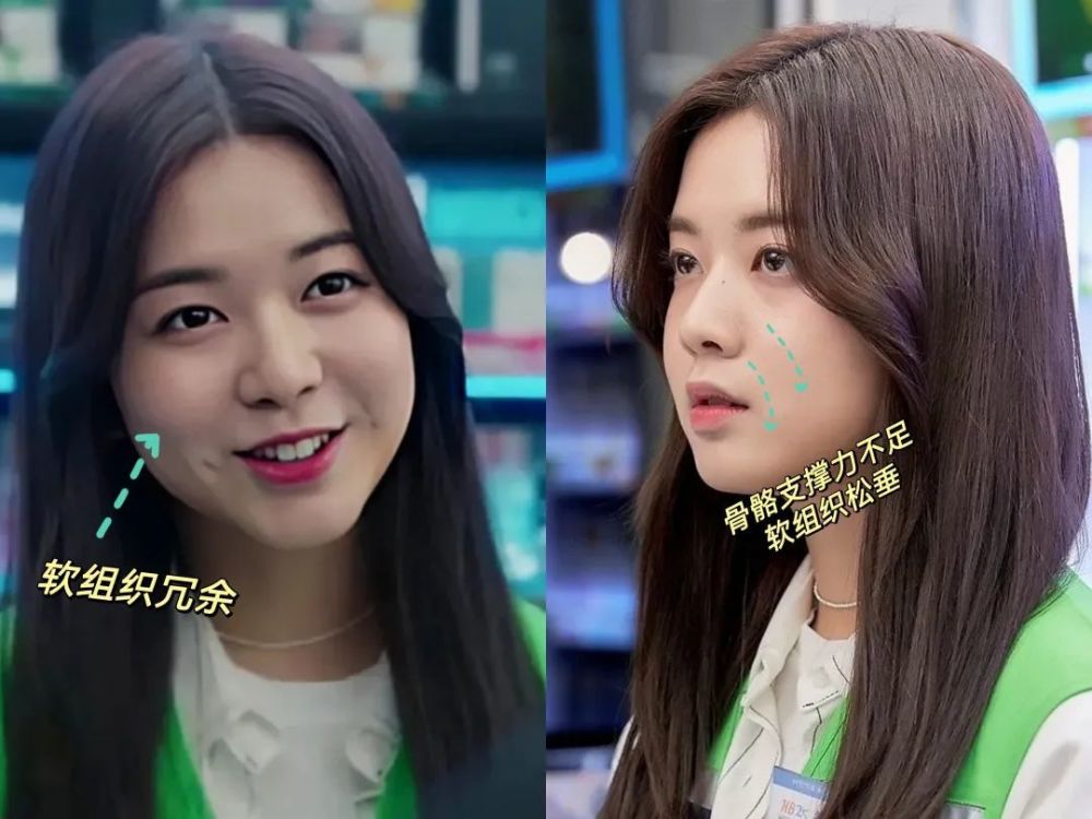 从土气小妹到明艳爱豆脸卢正义到底做了啥