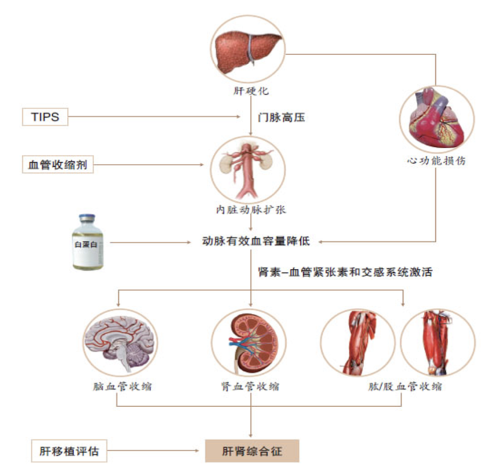 肝肾综合征发病机制及针对发病环节的治疗原则按照既往观点,hrs属于
