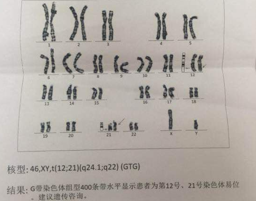 人类染色体正常图片