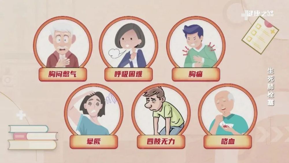 远离威胁生命的肺栓塞这些人群需格外警惕