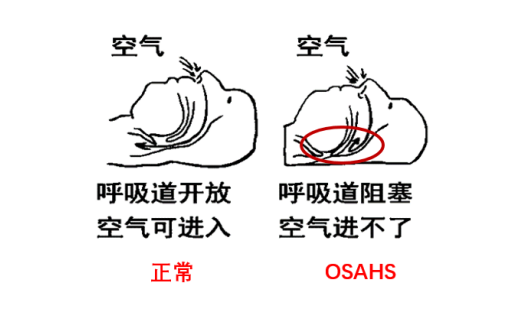 要小心一種叫