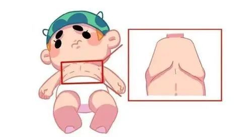 婴儿肋骨正常图图片