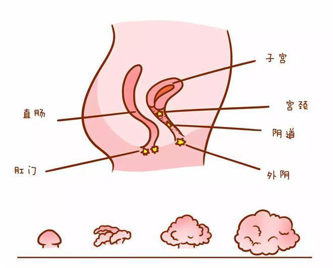 当发现肛门长肉芽的情况,不可自行判断,要尽早到医院就诊,避免肉芽