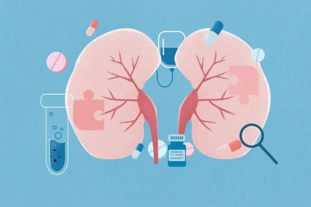 ④ 腎結石疼痛表現:若結石嵌頓在輸尿管會發生腎絞痛,表現為間歇性