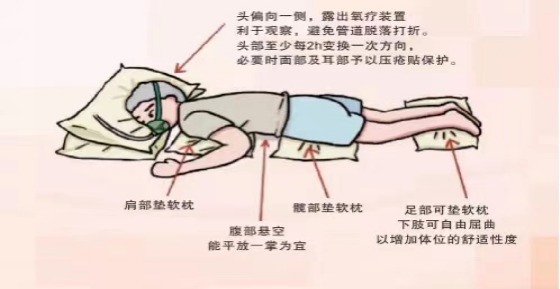 淺談新冠趴之俯臥位通氣