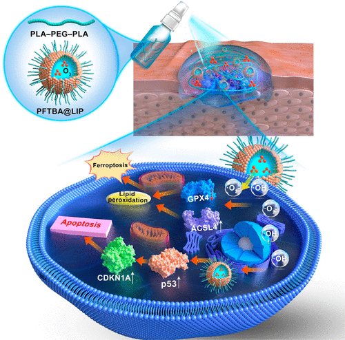 温敏性富臭氧喷雾凝胶通过铁死亡和细胞凋亡治疗肝细胞癌术后示意图