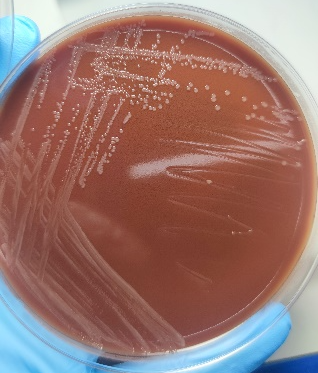 标本接种血琼脂培养基和巧克力琼脂培养基,置于5%co2培养箱培养24小后