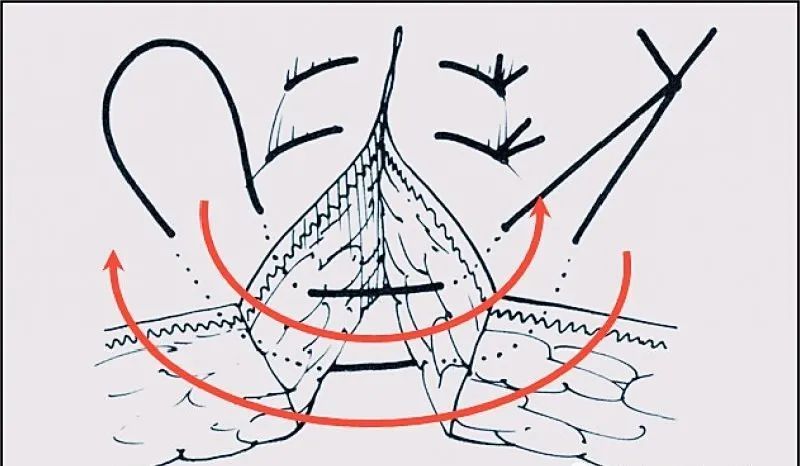 外科缝合秘籍详解常见手术切口缝合技术
