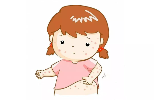 鸡西市疾控中心科普麻疹