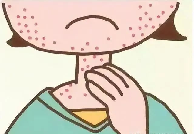 鸡西市疾控中心科普:风疹_腾讯新闻