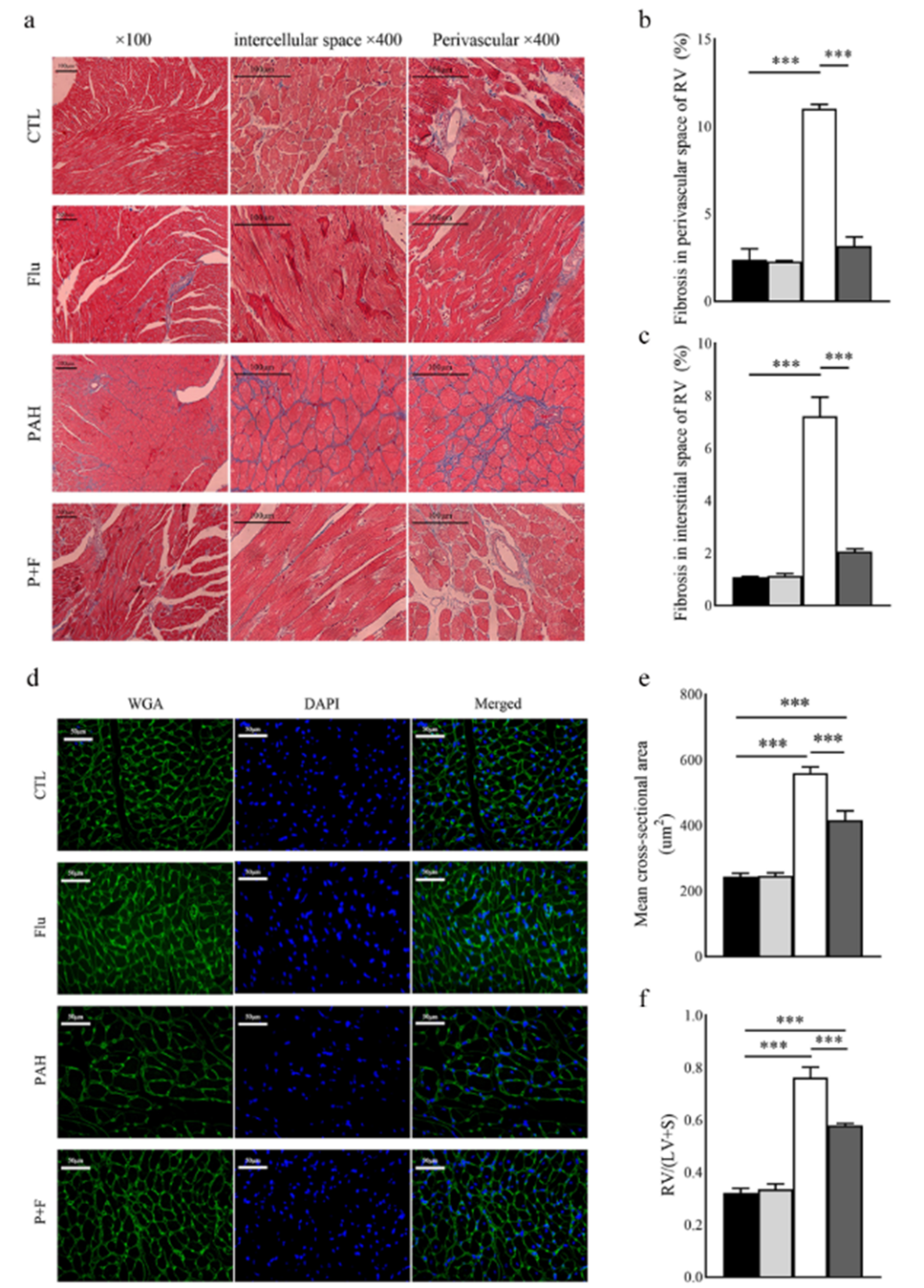(a)右室中masson染色的代表性图像(原始放大倍数×100和×400),(b)