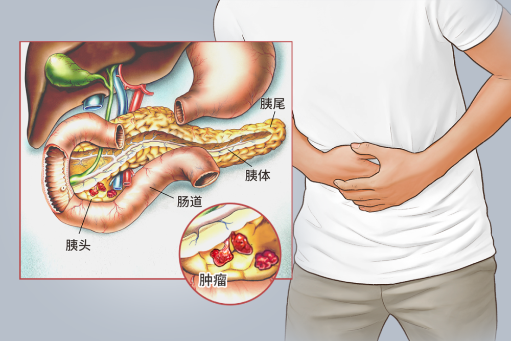 胃和胰腺不舒服的区别图片