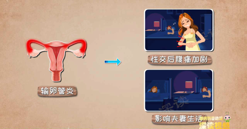 下腹隐隐作痛白带增多有异味会搞出宫外孕的输卵管炎是啥样