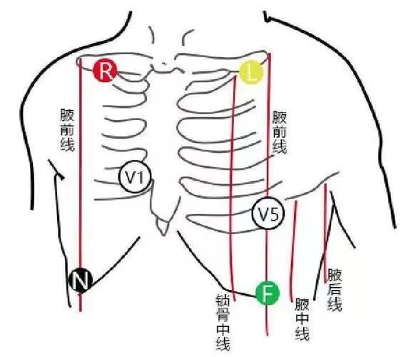 二,心電監護注意事項:1,心電監護使用時需要連接電源,注意用電安全.