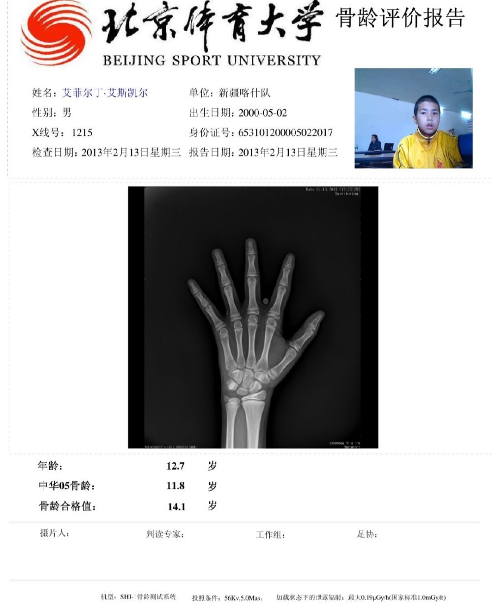 曝艾菲尔丁年龄造假,疑似骨龄检测图被晒出_腾讯新闻