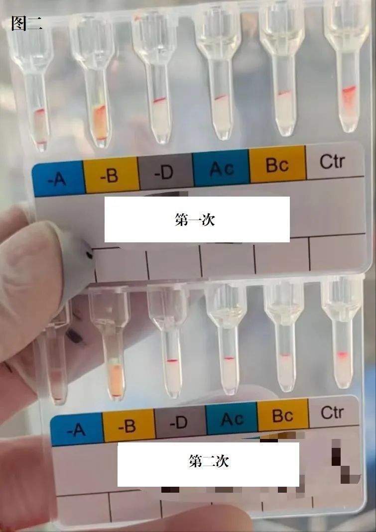 新冠感染患者,血型鉴定遇到了"麻烦"……_腾讯新闻