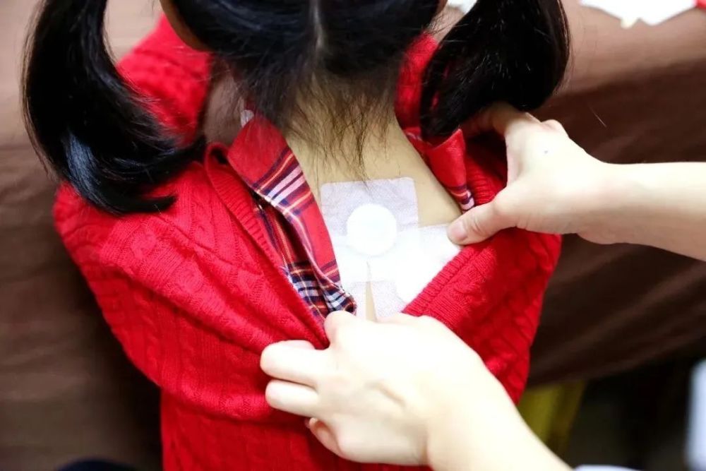 孩子身材矮小天门市中医医院推出小儿生长贴