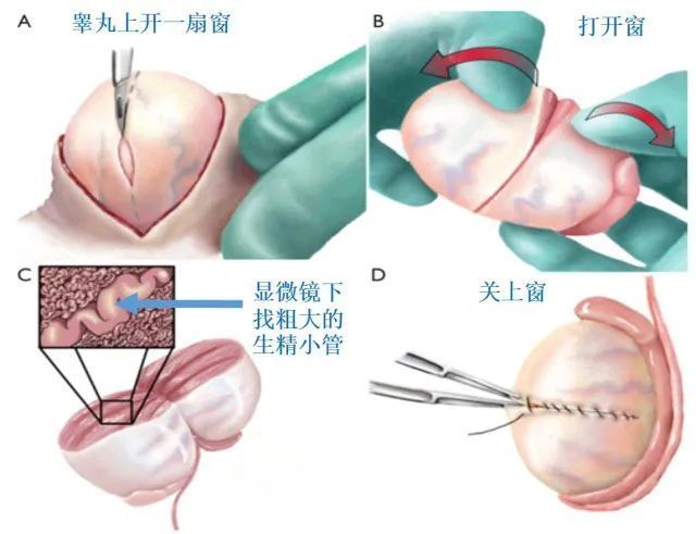 最後男的一查:沒有精子,沒有用