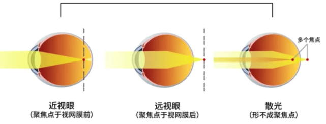 配眼镜时，验光机里你盯着看的“红房子”有啥秘密？｜No.62医生说_腾讯新闻