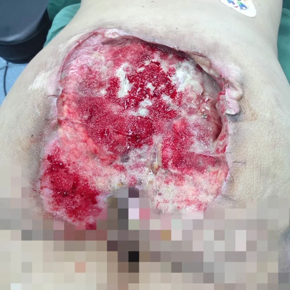 谁知道手术做了还真棒!