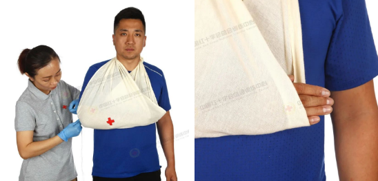 救在身边|现场包扎技术之三角巾悬臂带_腾讯新闻