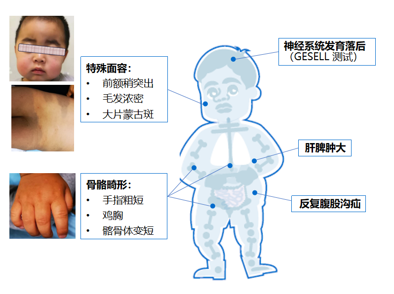特殊面容 腾讯网
