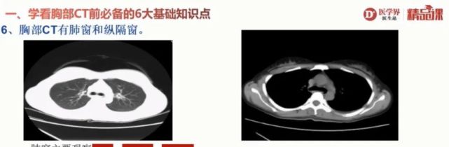 手把手教你读懂胸部CT｜看图诊断_腾讯新闻
