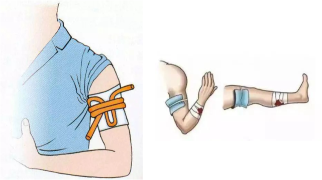 是有较强弹性的橡皮条,急救时可就地取材,用三角巾,布条或毛巾等代替