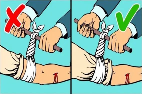 外伤急救止血"小宝典"_腾讯新闻