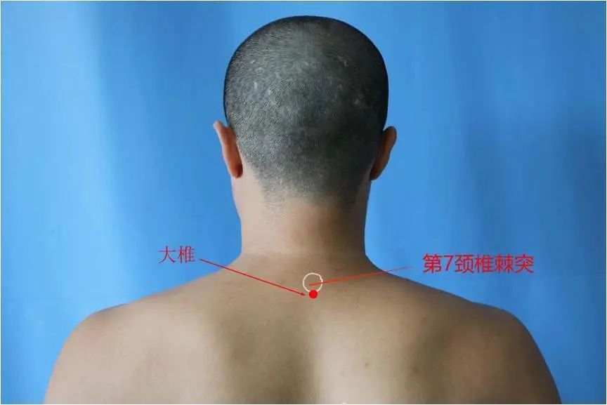 世界艾乡资讯-甲流不要慌,艾灸来帮忙-健康资讯-世界艾乡官方网站