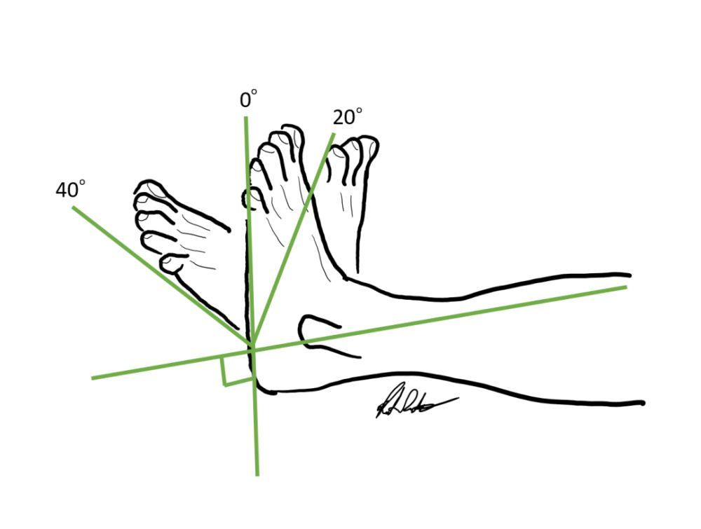 物理治療師視角踝背屈小角度大問題