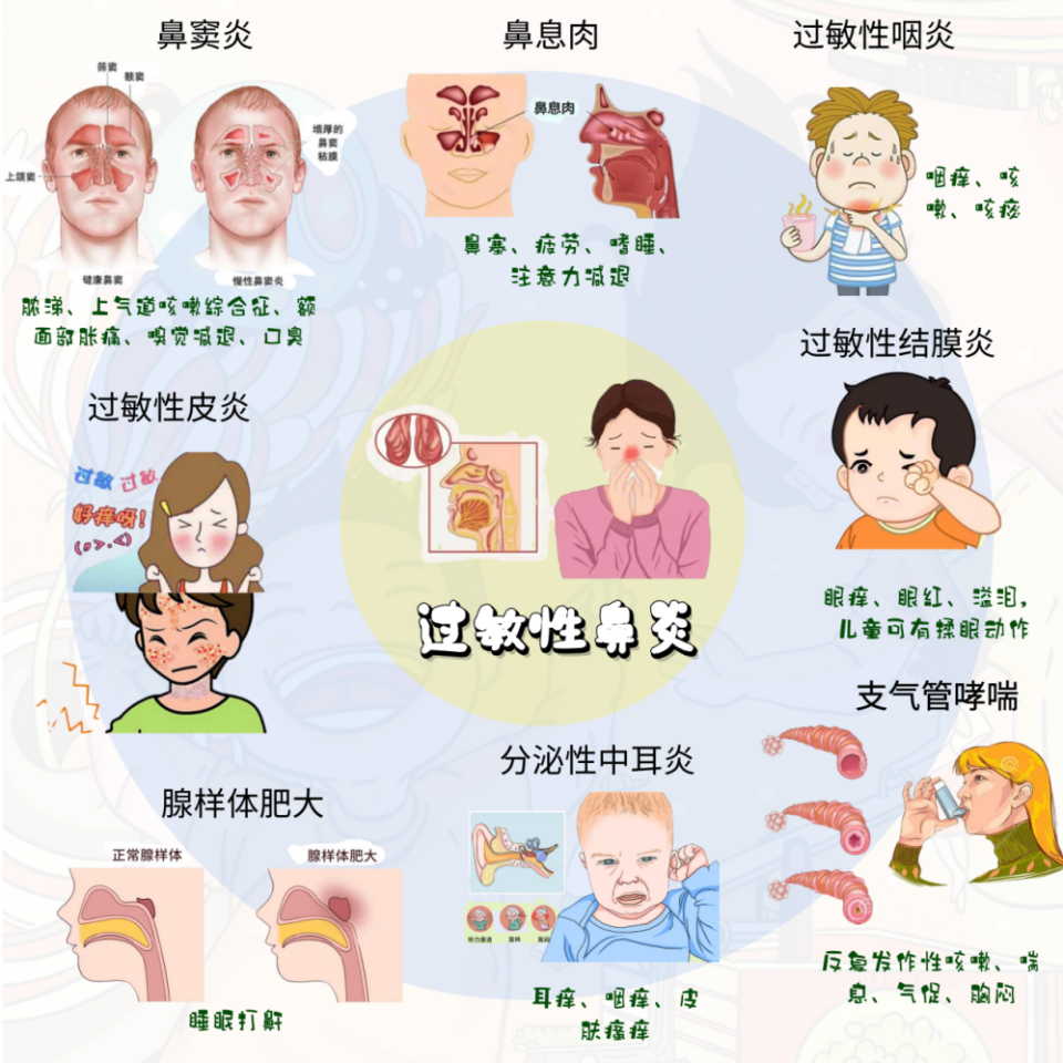 过敏性鼻炎传染吗 腾讯网