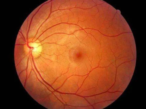 邹平爱尔眼科:春暖花开日,护眼正当时,今年的眼底筛查你做了吗?